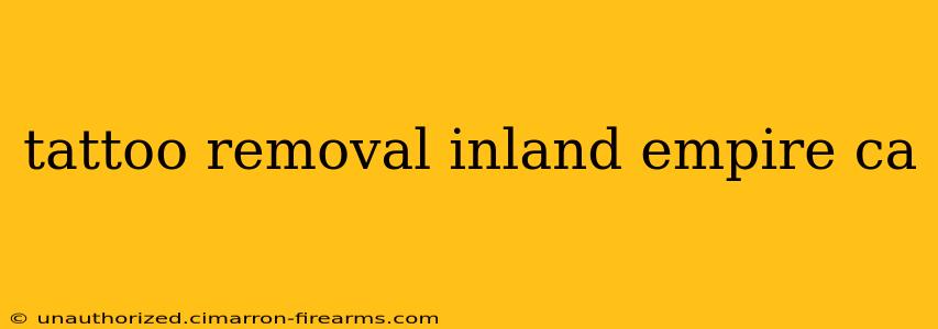 tattoo removal inland empire ca